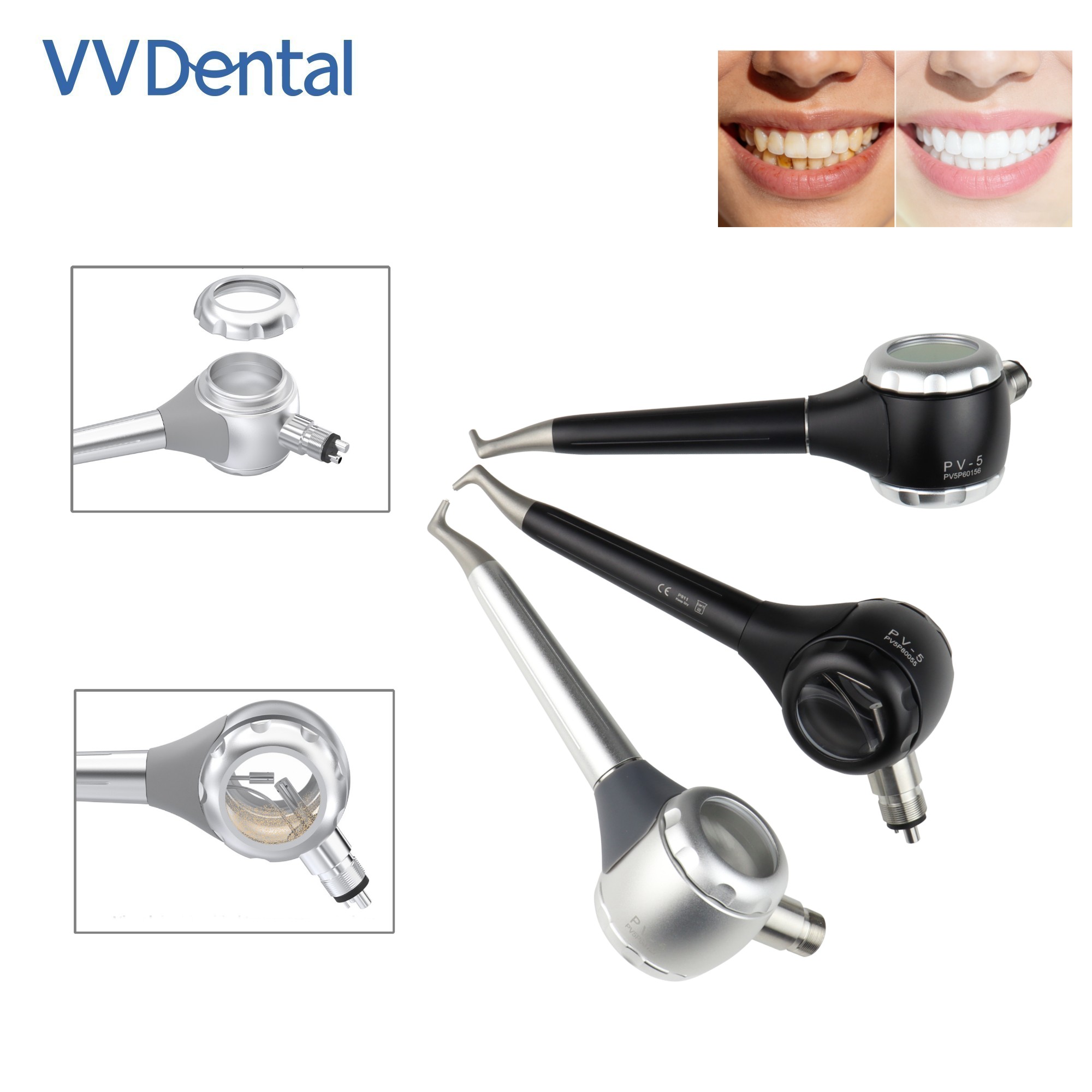 Teeth Whitening Dental - Pistola per Sabbiatura Dentale VV a