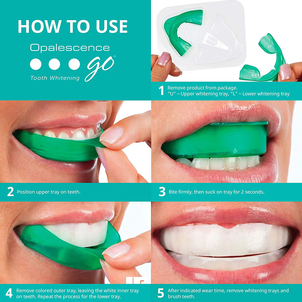 Perossido di idrogeno per sbia - Teeth Whitening At Home recensione e prezzo