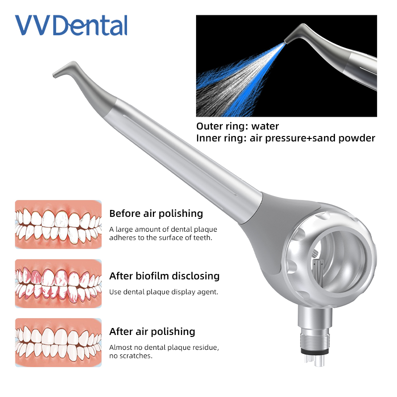 Pistola per Sabbiatura Dentale - Teeth Whitening Dental recensione e prezzo