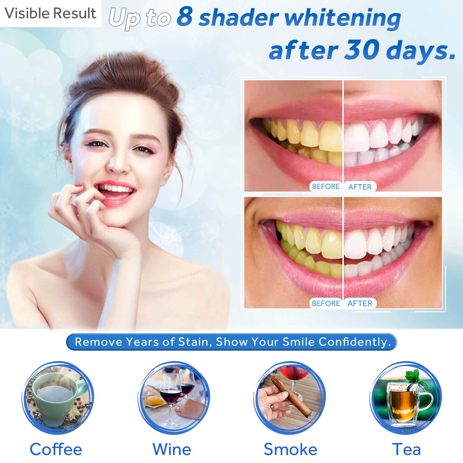 Gel sbiancante per denti Ricar - Teeth Whitening At Home recensione e prezzo