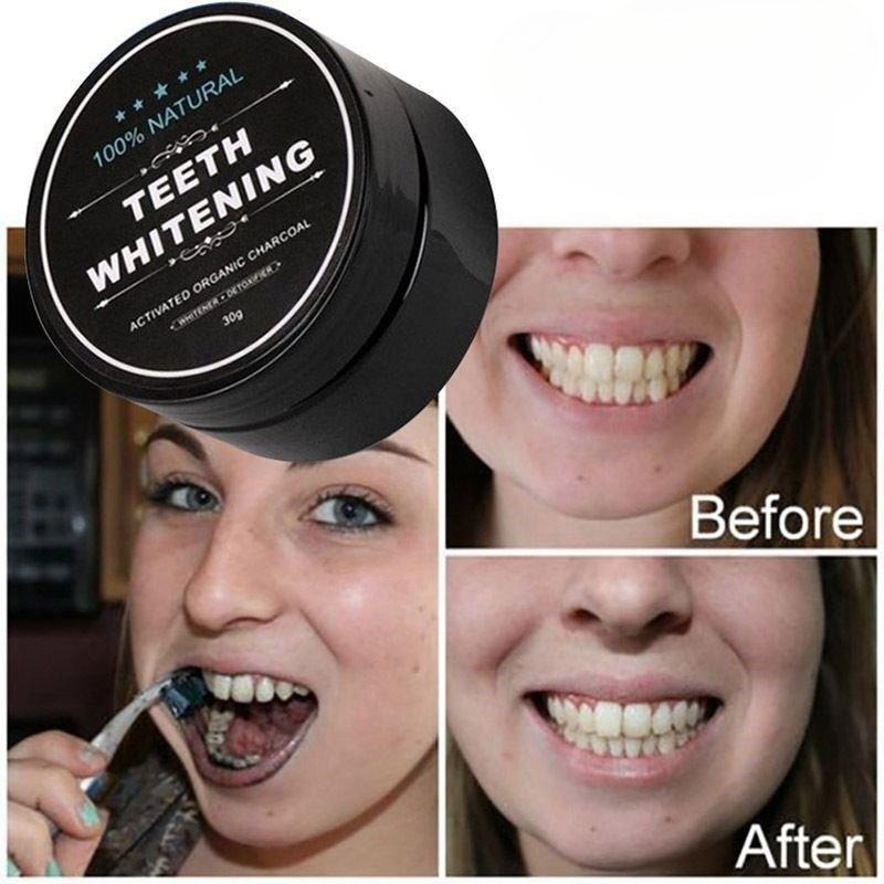 1 scatola di polvere per sbian - Whitening Powder Activated recensione e prezzo