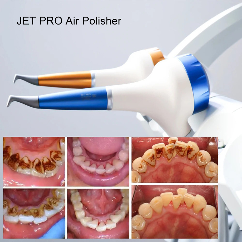 VV Dental Air Polishing Prophy - Teeth Whitening Dental recensione e prezzo
